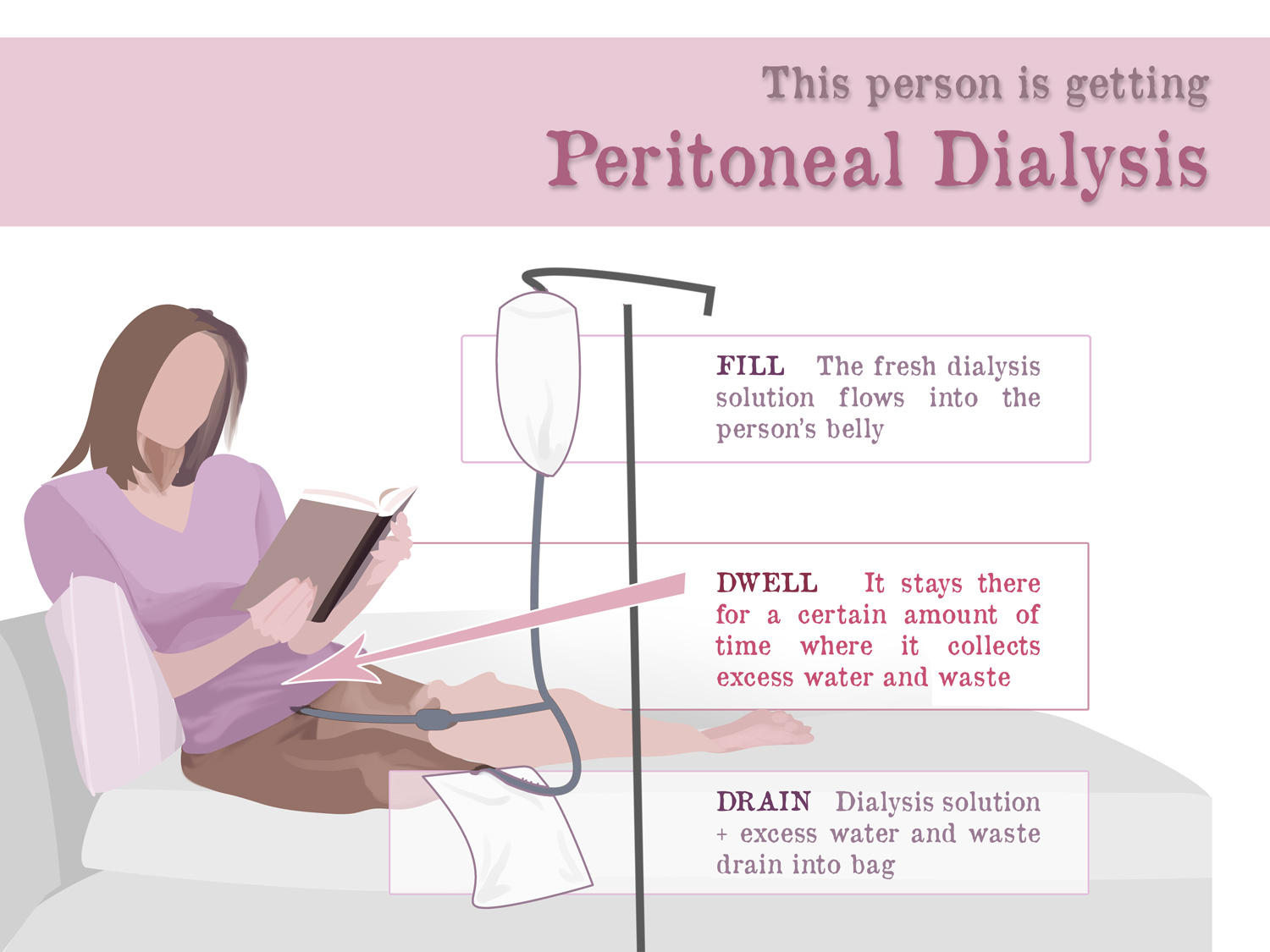peritoneal-dialysis-gaytri-manek-formerly-gandotra-md